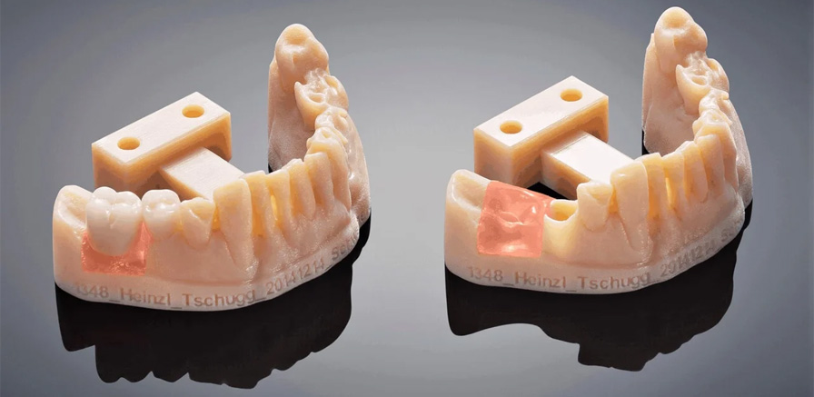 پرینت سه بعدی دندان| dental 3d printing| 3bowdi.com