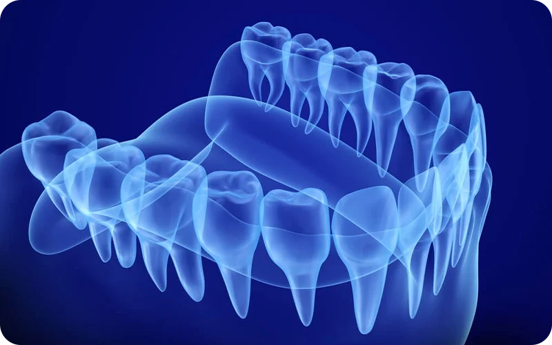 کاربرد اسکن سه‌بعدی برای مدلسازی سه بعدی دندان و دهان و فک 3d-scanner-application-dental-teeth-3d-modeling