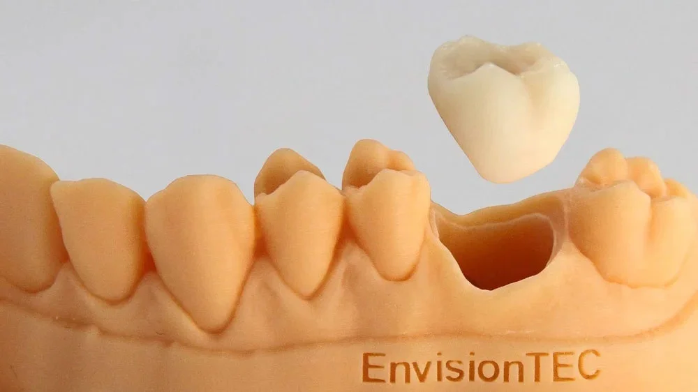 کاربرد پرینترهای سه بعدی در دندان پزشکی و دندان سازی dental 3d printing application crowns تاج دندان
