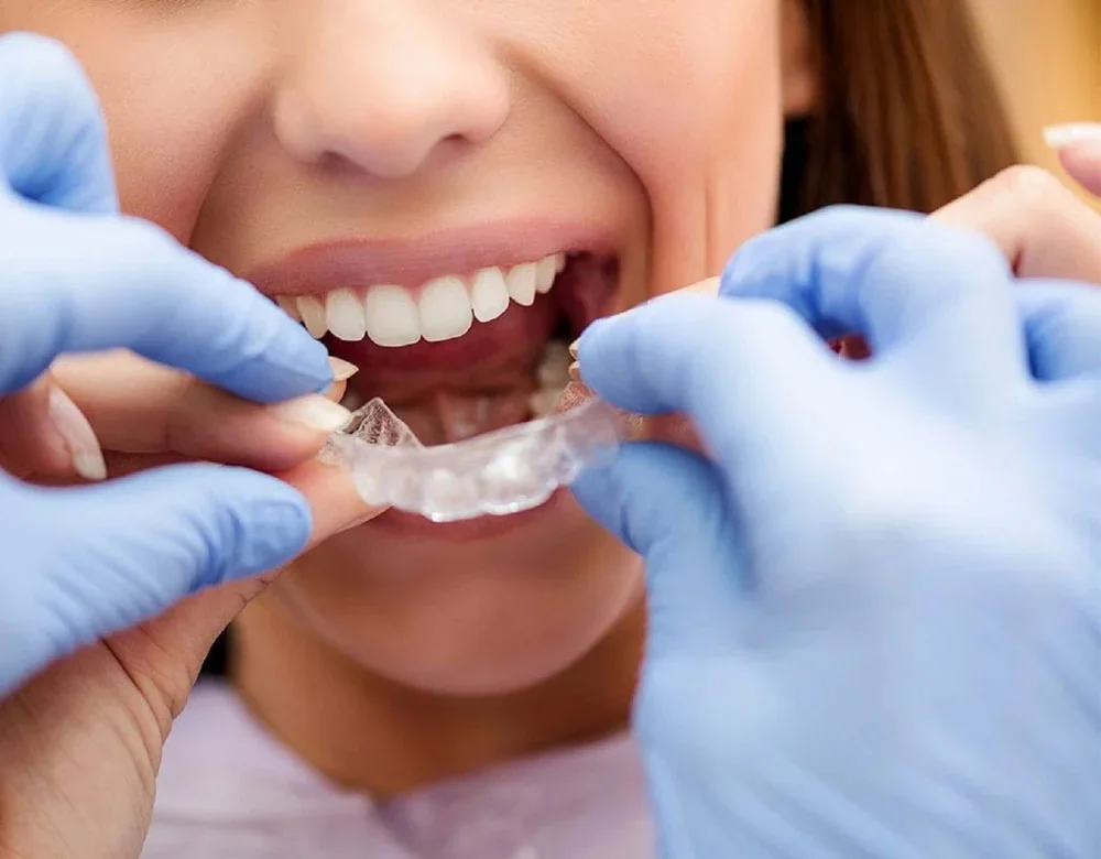 کاربرد پرینترهای سه بعدی در دندان پزشکی و دندان سازی dental 3d printing application aligner and night guard